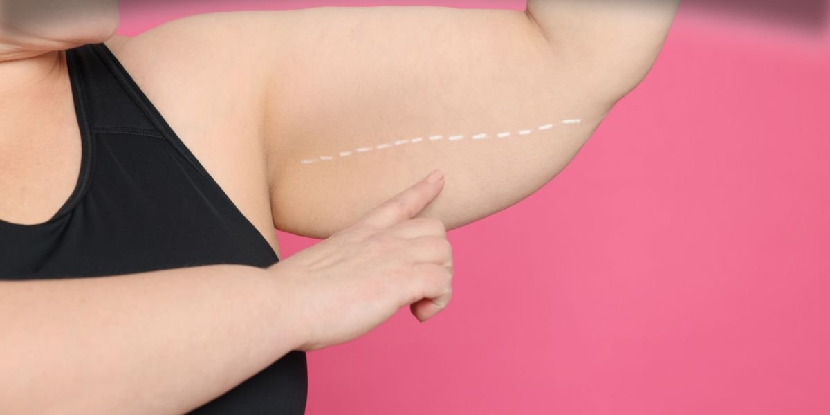 Leia mais sobre o artigo TJSP Reafirma Obrigação de Planos de Saúde em Cobrir Cirurgias Reparadoras Pós-Bariátricas